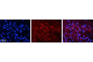 Rabbit Anti-DND1 Antibody     Formalin Fixed Paraffin Embedded Tissue: Human Pineal Tissue  Observed Staining: Cytoplasmic in pinealocytes  Primary Antibody Concentration: 1:100  Other Working Concentrations: 1/600  Secondary Antibody: Donkey anti-Rabbit-Cy3  Secondary Antibody Concentration: 1:200  Magnification: 20X  Exposure Time: 0.