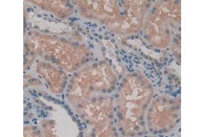 Used in DAB staining on fromalin fixed paraffin- embedded kidney tissue