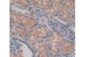 Used in DAB staining on fromalin fixed paraffin- embedded kidney tissue (Rhotekin anticorps  (AA 309-416))
