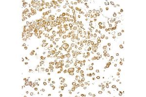 Immunocytochemistry (ICC) image for anti-Epidermal Growth Factor Receptor (EGFR) (C-Term) antibody (ABIN7795642) (Recombinant EGFR anticorps  (C-Term))