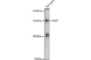 Western blot analysis of extracts of Rat brain, using ULK1 antibody (ABIN6134005, ABIN6149921, ABIN6149922 and ABIN6224624) at 1:500 dilution.