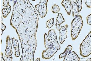 IHC analysis of MOV10 using anti-MOV10 antibody (ABIN7600236). (MOV10 anticorps  (AA 167-772))