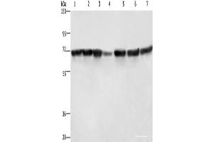 Western blot analysis of Hela cells HT29 cells human fetal liver tissue Human testis tissue 231 cells K562 cells human bladder transitional cell carcinoma tissue using LMNB1 Polyclonal Antibody at dilution of 1:750 (Lamin B1 anticorps)