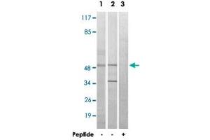 Western blot analysis of extracts from HeLa cells (Lane 1) and Jurkat cells (Lane 2 and lane 3), using MYLIP polyclonal antibody . (MYLIP anticorps)