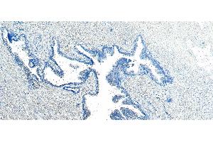 (ABIN185182) Negative Control showing staining of paraffin embedded Human Prostate, with no primary antibody. (VPS35 anticorps  (C-Term))