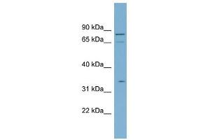 SLC5A9 antibody used at 1 ug/ml to detect target protein. (SLC5A9 anticorps)