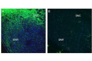 Expression of SLC41A2 in mouse midbrain. (SLC41A2 anticorps  (Extracellular, N-Term))