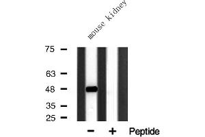 Western blot analysis of HDAC3 expression in Mouse kidney lysate