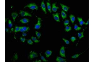 Immunofluorescence staining of A549 cells with ABIN7173972 at 1:133, counter-stained with DAPI.