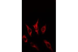 ABIN6274613 staining HepG2 cells by IF/ICC. (CCRL1 anticorps  (C-Term))