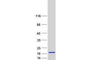 Validation with Western Blot