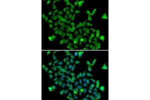 Immunofluorescence analysis of MCF-7 cells using ASPA antibody (ABIN6127373, ABIN6137211, ABIN6137212 and ABIN6223094). (ASPA anticorps  (AA 1-313))