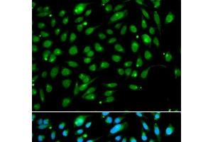 Immunofluorescence analysis of A549 cells using ING3 Polyclonal Antibody (ING3 anticorps)