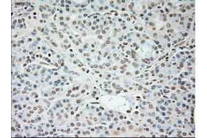 Immunohistochemistry (IHC) image for anti-Cardiac Troponin I (TNNI3) (AA 1-210) antibody (ABIN1490609) (TNNI3 anticorps  (AA 1-210))