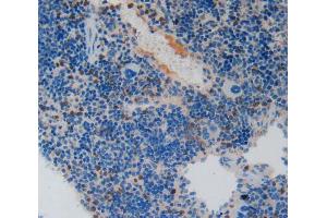 Used in DAB staining on fromalin fixed paraffin- embedded spleen tissue (PAI1 anticorps  (AA 141-389))