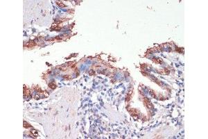 Immunohistochemistry of paraffin-embedded Rat lung using MSI1 Polyclonal Antibody at dilution of 1:200 (40x lens). (MSI1 anticorps)