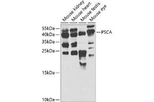 Western blot analysis of extracts of various cell lines, using PSCA antibody  at 1:1000 dilution. (PSCA anticorps  (AA 12-114))