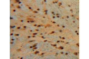 Used in DAB staining on fromalin fixed paraffin-embedded brain tissue (Midkine anticorps  (AA 22-140))