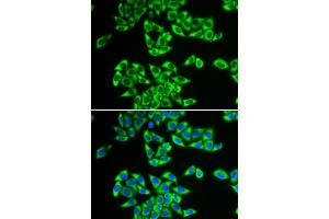 Immunofluorescence analysis of HeLa cells using DDX3X antibody (ABIN5973285). (DDX3X anticorps)