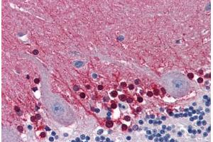 Human Brain, Cerebellum: Formalin-Fixed, Paraffin-Embedded (FFPE)