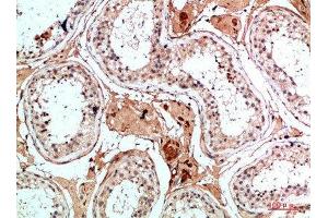 Immunohistochemical analysis of paraffin-embedded human-testis, antibody was diluted at 1:200 (Nanos Homolog 1 anticorps  (AA 151-200))