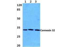 Western blot analysis of Connexin 32 (L115) Antibody at 1/500 dilution:  Lane 1: Hela cell lysate. (GJB1 anticorps)