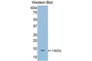 Western blot analysis of the recombinant protein. (IL1R1 anticorps  (AA 226-318))