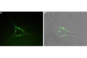 Expression of P2RY1 in rat PC12 cells - Cell surface detection of P2RY1 in intact living rat pheochromocytoma (PC12) cells.