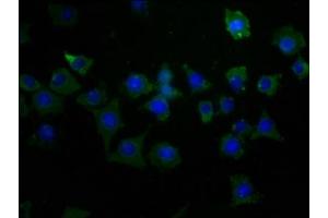 Immunofluorescence staining of SH-SY5Y cells with ABIN7163961 at 1:50, counter-stained with DAPI.