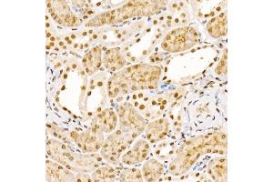 Immunohistochemistry of paraffin-embedded mouse kidney using UBB Rabbit pAb (ABIN6130181, ABIN6149775, ABIN6149776 and ABIN6222958) at dilution of 1:200 (40x lens). (UBASH3B anticorps  (AA 1-300))