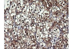 Image no. 1 for anti-butyrobetaine (Gamma), 2-Oxoglutarate Dioxygenase (Gamma-butyrobetaine Hydroxylase) 1 (BBOX1) antibody (ABIN1496819)