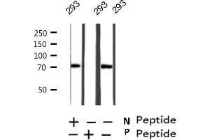 Western blot analysis on 293 cell lysate using Phospho-RIPK2(Ser176) Antibody (RIPK2 anticorps  (pSer176))