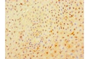 Immunohistochemistry of paraffin-embedded human tonsil tissue using ABIN7174796 at dilution of 1:100 (C1orf54 anticorps  (AA 17-131))