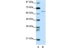 WB Suggested Anti-RFX5 Antibody Titration:  2. (RFX5 anticorps  (N-Term))