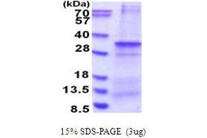 SDS-PAGE (SDS) image for Canopy 4 Homolog (CNPY4) (AA 22-248) protein (His tag) (ABIN6387433)