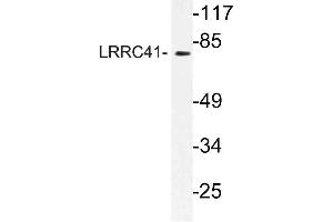 Western blot (WB) analysis of LRRC41 antibody in extracts from rat heart cells. (LRRC41 anticorps)