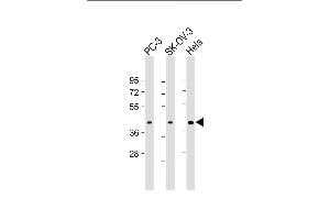 All lanes : Anti-ST3GAL4 Antibody (N-Term) at 1:1000-1:2000 dilution Lane 1: PC-3 whole cell lysate Lane 2: SK-OV-3 whole cell lysate Lane 3: Hela whole cell lysate Lysates/proteins at 20 μg per lane. (ST3GAL4 anticorps  (AA 26-57))