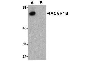Western blot analysis of ACVR1B in human kidney tissue lysate with AP30015PU-N ACVR1B antibody at 1 μg/ml in (A) the absence and (B) the presence of blocking peptide. (Activin A Receptor Type IB/ALK-4 anticorps  (C-Term))