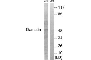 Immunohistochemistry analysis of paraffin-embedded human heart tissue using Dematin (Ab-403) antibody. (Dematin anticorps  (Ser403))