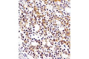 (ABIN654625 and ABIN2844322) staining D11b in human tonsil tissue sections by Immunohistochemistry (IHC-P - paraformaldehyde-fixed, paraffin-embedded sections).