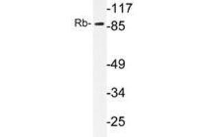 Western blot analysis of Rb antibody in extracts from HeLa cells. (Retinoblastoma 1 anticorps)