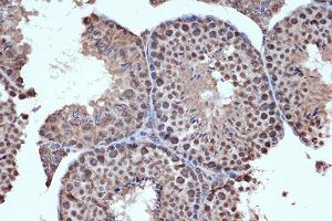 Immunohistochemistry of paraffin-embedded mouse testis using HD Rabbit mAb (ABIN7267714) at dilution of 1:100 (40x lens).