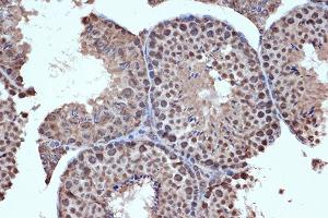 Immunohistochemistry of paraffin-embedded mouse testis using HD Rabbit mAb (ABIN7267714) at dilution of 1:100 (40x lens). (HDAC8 anticorps)