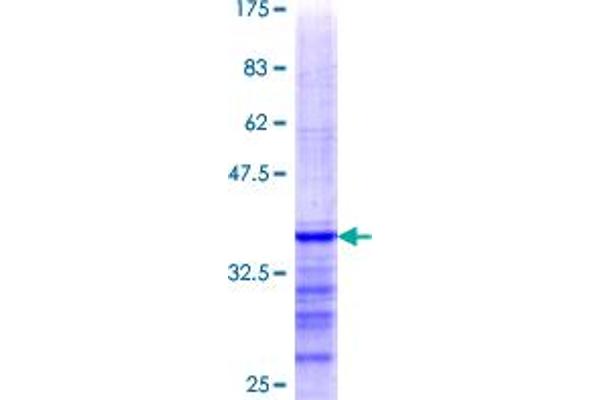 TPD52L1 Protein (AA 60-144) (GST tag)