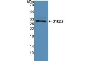 Western blot analysis of recombinant Human F13A1. (F13A1 anticorps  (AA 107-345))