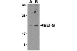 Western blot analysis of Bcl-G in U937 cell lysates with Bcl-G antibody at (A) 2.