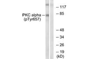 Western blot analysis of extracts from COLO205 cells, using PKC alpha (Phospho-Tyr657) Antibody. (PKC alpha anticorps  (pTyr657))