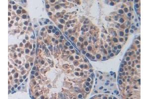 Detection of PARP in Mouse Testis Tissue using Polyclonal Antibody to Poly ADP Ribose Polymerase (PARP)