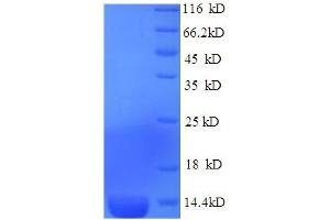SDS-PAGE (SDS) image for Serum Amyloid A (SAA) (AA 1-110), (full length) protein (His tag) (ABIN5710310)