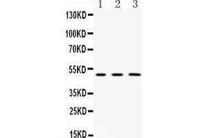 Western blot analysis of CNPase expression in rat  brain extract ( Lane 1), mouse brain extract ( Lane 2) and HELA whole cell lysates ( Lane 3). (Cnpase anticorps  (Middle Region))